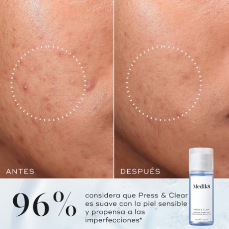 Medik8 Press & Clear Tónico y Exfoliante, 150 ml
