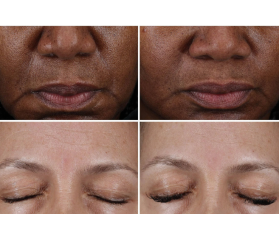 SkinCeuticals Cell Cycle Catalyst Sérum Exfoliante Antiedad, 30 ml