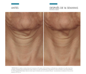 SkinCeuticals TRIPEPTIDE-R NECK REPAIR Tratamiento Anti-Edad para Cuello, 50 ml