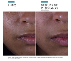 SkinCeuticals Silymarin CF, 30 ml