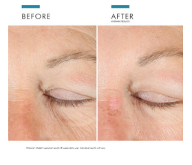 SkinCeuticals A.G.E. Advanced Eye, 15 ml