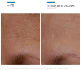 SkinCeuticals A.G.E. Interrupter Crema Antiedad, 48 g