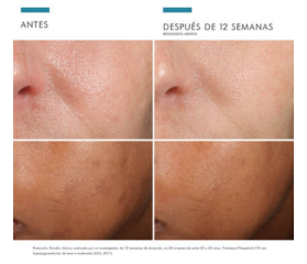 SkinCeuticals Phloretin CF Sérum Antioxidante Antiedad, 30 ml