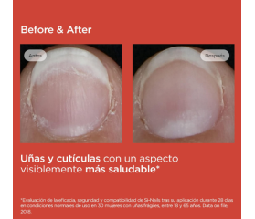 ISDIN SI-NAILS Fortalecedor de Uñas