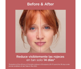 ISDIN FOTOULTRA REDNESS Protector Solar Facial SPF50, 50 ml