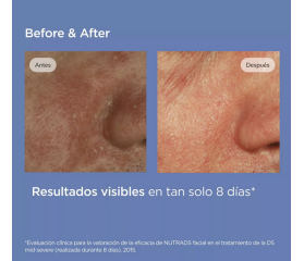 ISDIN NUTRADEICA Gel - Crema Facial, 50 ml