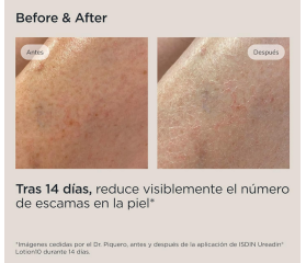 ISDIN UREADIN LOCION 10% Loción Corporal con Dosificador, 400 ml