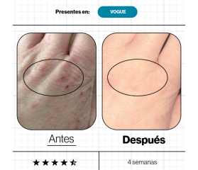 Advanced Nutrition SKIN OMEGAS+, 60 cápsulas