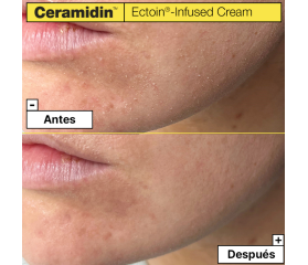 DR JART CERAMIDIN Crema Ectoin, 50 ml