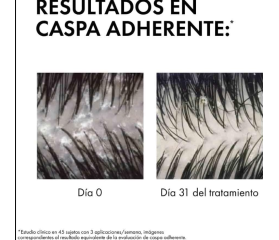 VICHY DERCOS CHAMPU CASPA GRASA 400 + RECARGA