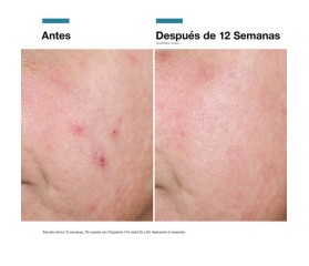 SkinCeuticals Advanced RGN-6 50ml