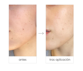 NIEVES ÁLVAREZ TOTAL CLEANSING SOLUTION 100ML
