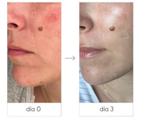 NIEVES ÁLVAREZ POWER FIRM PEPTIDE SERUM 30 ML