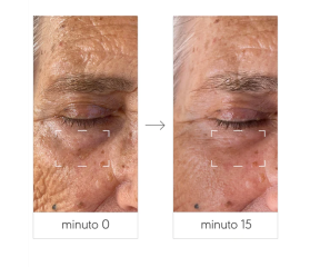 NIEVES EYE LIFTING CREAM 15ML