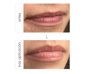 NIEVES ÁLVAREZ TRIPLE ACTION LIP ELIXIR 8 ML