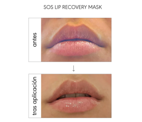 NIEVES ÁLVAREZ LIP MASK & ELIXIR