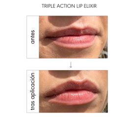 NIEVES ÁLVAREZ LIP MASK & ELIXIR
