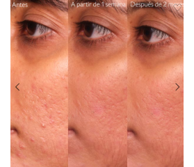 CAUDALIE VINOPURE SERUM ANTI-IMPERFECCIONES, 30 ml