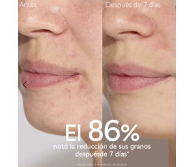 CAUDALIE VINOPURE SERUM ANTI-IMPERFECCIONES, 30 ml