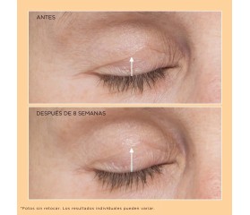 Perricone Neuropeptide Eyelid Lift Serum 15ml