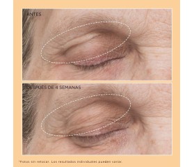 Perricone Neuropeptide Eyelid Lift Serum 15ml