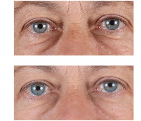 Perricone High Potency Hyaluronic Intensive Hidrating Serum 59ml