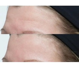 Perricone Neuropeptide Facial Cream 74ml