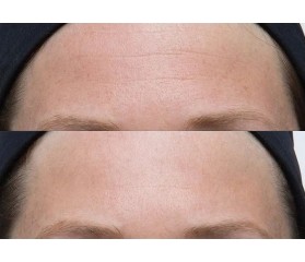 Perricone Neuropeptide Facial Cream 74ml