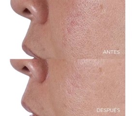 Perricone High Potency Tonico Finishing & Firming 118 ml