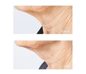 Perricone Cold Plasma Crema Cuello 59 ml