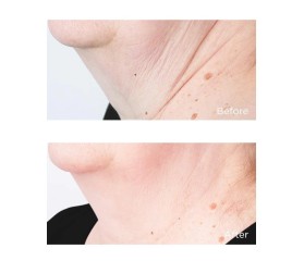 Perricone Cold Plasma Crema Cuello 59 ml