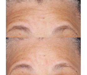 Perricone Hypoallergenic Barrier Repair Crema 59 ml