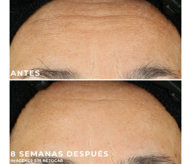 ROC Retinol Correxion Line Smoothing Sérum en Cápsulas