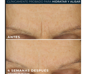 ROC Retinol Correxion Wrinkle Correct Sérum