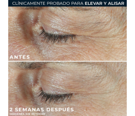 ROC Derm Correxion Targeted Solutions Dual Eye