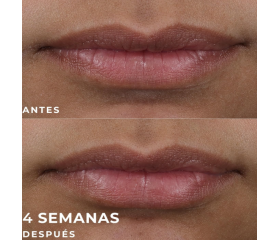 ROC Derm Correxion Targeted Solutions Lip Volumizer