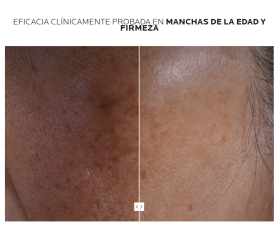 La Roche Posay MELA B3 DOUBLE DOSE 50 ML
